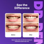 DRDENT Purple Teeth Whitening Strips