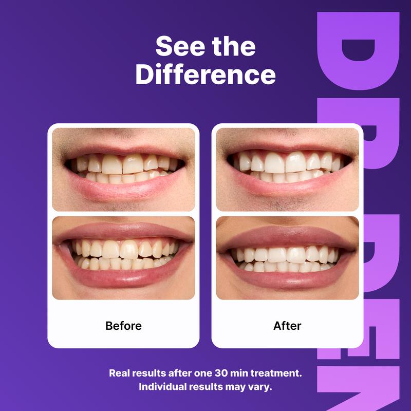 DRDENT Purple Teeth Whitening Strips