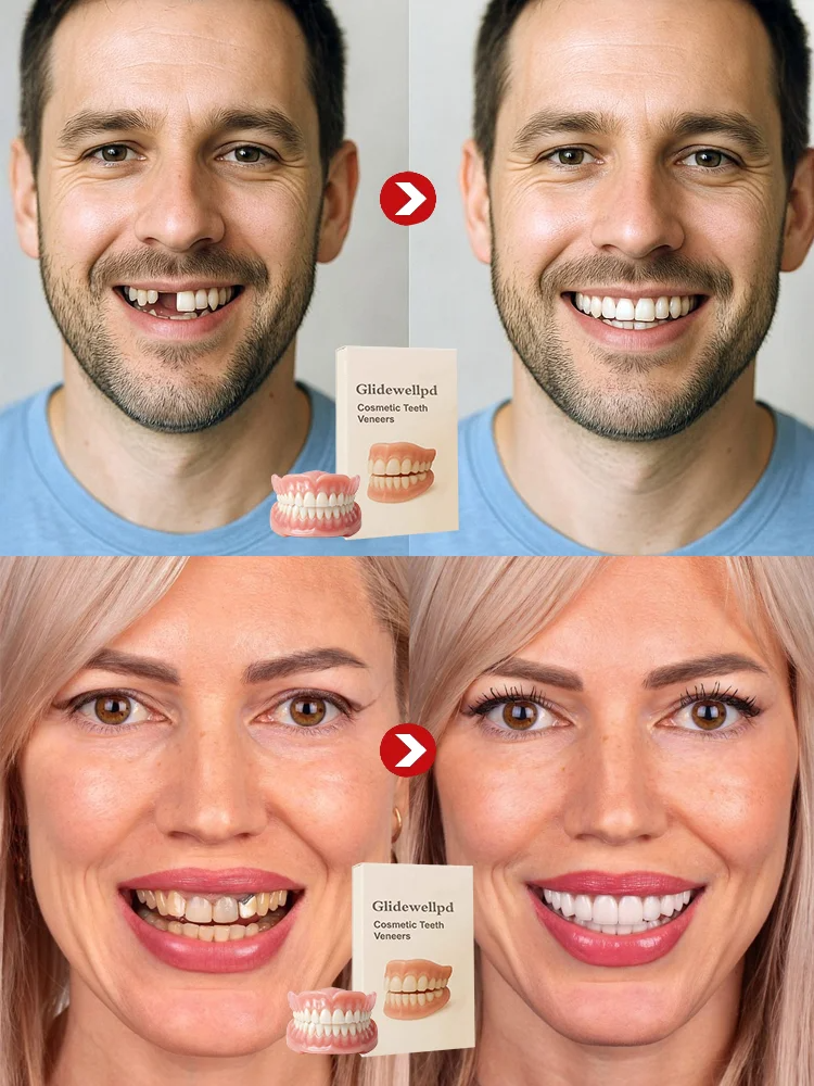 Premium All-Inclusive Full Dentures, No Dentist Required, Regain Your Confidence