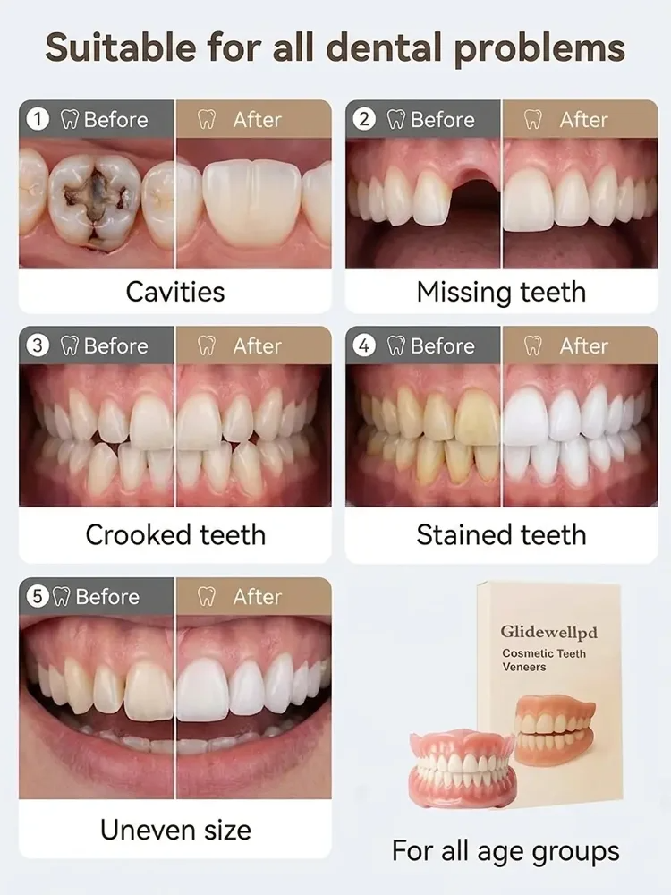 Premium All-Inclusive Full Dentures, No Dentist Required, Regain Your Confidence