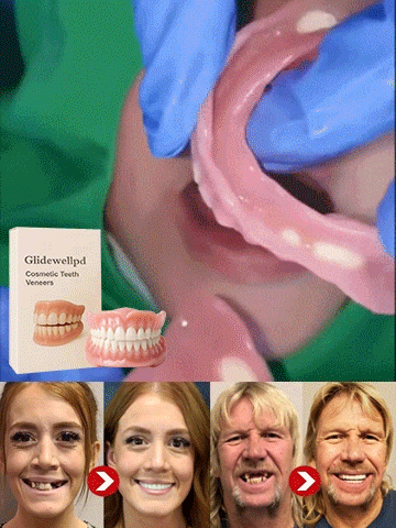 Premium All-Inclusive Full Dentures, No Dentist Required, Regain Your Confidence